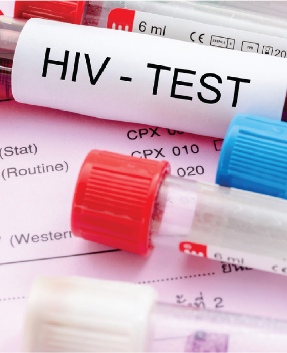 HIV